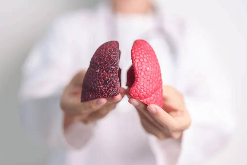 Doctor holding a healthy lung model next to a damaged lung model