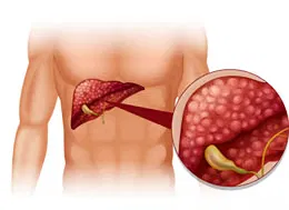 Illustration of the liver and gallbladder in the upper abdomen with a close-up of the liver